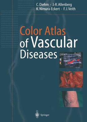 Diehm / Allenberg / Veith |  Color Atlas of Vascular Diseases | Buch |  Sack Fachmedien