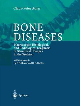 Adler |  Bone Diseases | Buch |  Sack Fachmedien