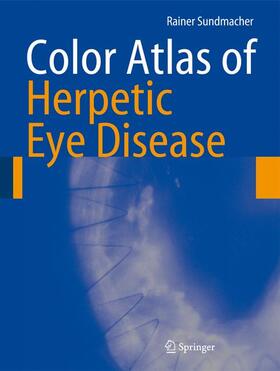 Sundmacher |  Color Atlas of Herpetic Eye Disease | Buch |  Sack Fachmedien
