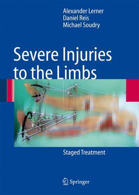 Lerner / Soudry / Reis |  Severe Injuries to the Limbs | Buch |  Sack Fachmedien