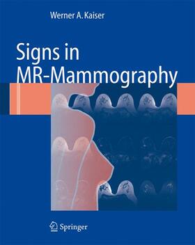 Kaiser |  Signs in MR-Mammography | Buch |  Sack Fachmedien