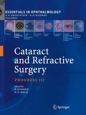 Koch / Kohnen |  Cataract and Refractive Surgery | Buch |  Sack Fachmedien