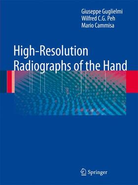 Guglielmi / Cammisa / Peh |  High-Resolution Radiographs of the Hand | Buch |  Sack Fachmedien