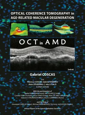 Coscas |  Optical Coherence Tomography in Age-Related Macular Degeneration | Buch |  Sack Fachmedien