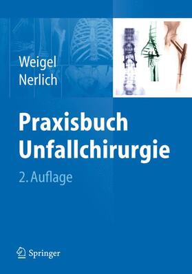 Weigel / Nerlich |  Praxisbuch Unfallchirurgie | Buch |  Sack Fachmedien