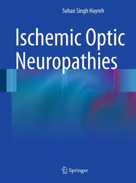 Hayreh |  Ischemic Optic Neuropathies | Buch |  Sack Fachmedien