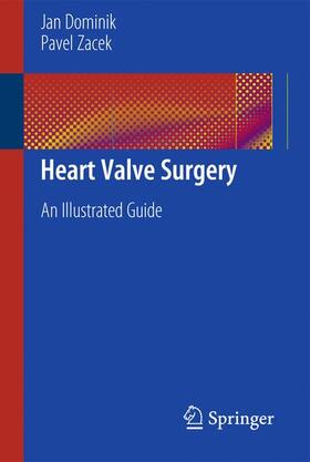 Zacek / Dominik |  Heart Valve Surgery | Buch |  Sack Fachmedien