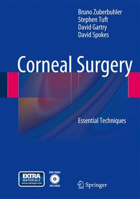 Zuberbuhler / Tuft / Garty |  Corneal Surgery | Buch |  Sack Fachmedien