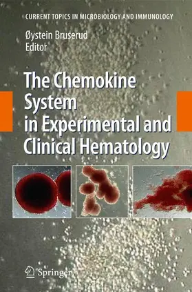 Bruserud |  The Chemokine System in Experimental and Clinical Hematology | Buch |  Sack Fachmedien