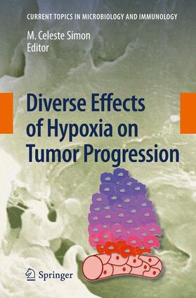 Simon |  Diverse Effects of Hypoxia on Tumor Progression | Buch |  Sack Fachmedien