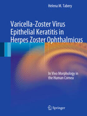 Tabery |  Varicella-Zoster Virus Epithelial Keratitis in Herpes Zoster Ophthalmicus | Buch |  Sack Fachmedien