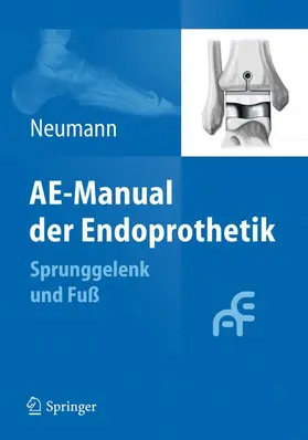 Neumann |  AE-Manual der Endoprothetik | Buch |  Sack Fachmedien