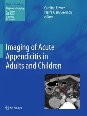 KEYZER / Gevenois |  Imaging of Acute Appendicitis in Adults and Children | Buch |  Sack Fachmedien