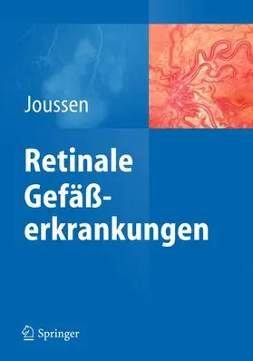 Joussen |  Retinale Gefäßerkrankungen | Buch |  Sack Fachmedien