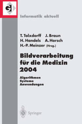 Tolxdorff / Braun / Handels |  Bildverarbeitung für die Medizin 2004 | eBook | Sack Fachmedien