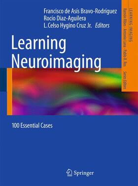 Bravo-Rodríguez / Diaz-Aguilera / Hygino Cruz |  Learning Neuroimaging | Buch |  Sack Fachmedien