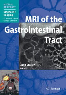 Stoker |  MRI of the Gastrointestinal Tract | Buch |  Sack Fachmedien