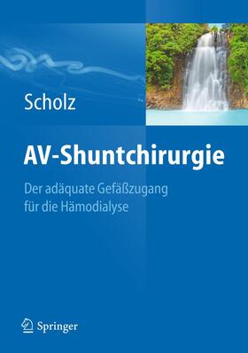 Scholz |  AV-Shuntchirurgie | Buch |  Sack Fachmedien