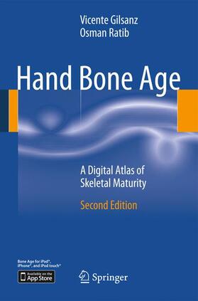 Ratib / Gilsanz |  Hand Bone Age | Buch |  Sack Fachmedien