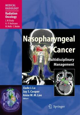 Lu / Lee / Cooper |  Nasopharyngeal Cancer | Buch |  Sack Fachmedien