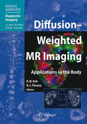 Thoeny / Koh |  Diffusion-Weighted MR Imaging | Buch |  Sack Fachmedien