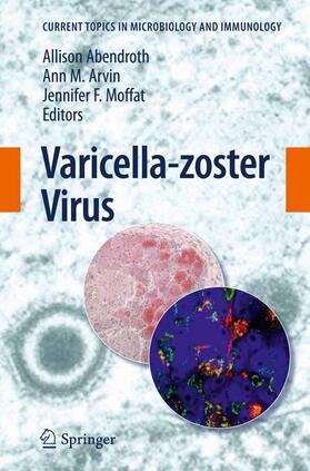 Abendroth / Moffat / Arvin |  Varicella-zoster Virus | Buch |  Sack Fachmedien