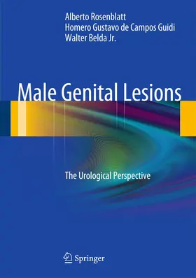 Rosenblatt / de Campos Guidi / Belda |  Male Genital Lesions | Buch |  Sack Fachmedien