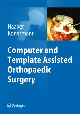 Konermann / Haaker |  Computer and Template Assisted Orthopedic Surgery | Buch |  Sack Fachmedien