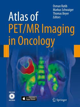 Ratib / Schwaiger / Beyer |  Atlas of PET/MR Imaging in Oncology | eBook | Sack Fachmedien