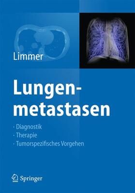 Limmer |  Lungenmetastasen | Buch |  Sack Fachmedien