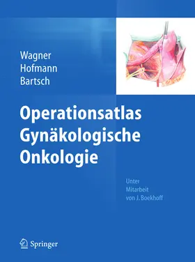 Wagner / Hofmann / Bartsch |  Operationsatlas Gynäkologische Onkologie | eBook | Sack Fachmedien