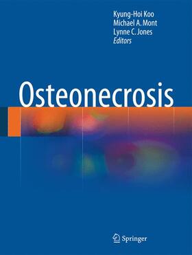 Koo / Jones / Mont |  Osteonecrosis | Buch |  Sack Fachmedien