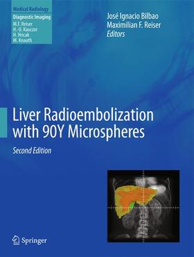 Bilbao / Reiser |  Liver Radioembolization with 90Y Microspheres | Buch |  Sack Fachmedien