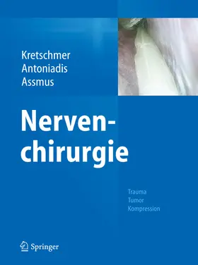 Kretschmer / Antoniadis / Assmus |  Nervenchirurgie | eBook | Sack Fachmedien