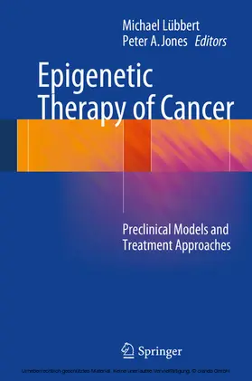 Lübbert / Jones | Epigenetic Therapy of Cancer | E-Book | sack.de