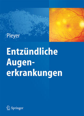 Pleyer |  Entzündliche Augenerkrankungen | eBook | Sack Fachmedien