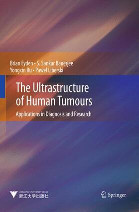 Eyden / Liberski / Banerjee |  The Ultrastructure of Human Tumours | Buch |  Sack Fachmedien