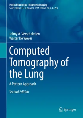 Verschakelen / De Wever |  Computed Tomography of the Lung | eBook | Sack Fachmedien