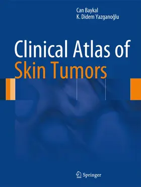 Baykal / Yazganoglu / Yazganoglu |  Clinical Atlas of Skin Tumors | Buch |  Sack Fachmedien