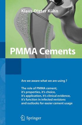 Kühn |  PMMA Cements | Buch |  Sack Fachmedien
