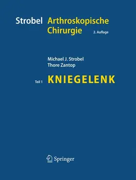 Strobel / Zantop |  Strobel Arthroskopische Chirurgie | Buch |  Sack Fachmedien