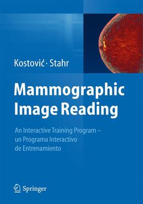 Kostovic / Kostovic / Stahr |  Mammographic Image Reading | Sonstiges |  Sack Fachmedien