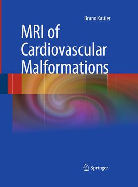 Kastler |  MRI of Cardiovascular Malformations | Buch |  Sack Fachmedien
