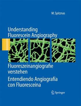 Spitznas |  Understanding Fluorescein Angiography, Fluoreszeinangiografie verstehen, Entendiendo Angiografía con Fluoresceína | Buch |  Sack Fachmedien