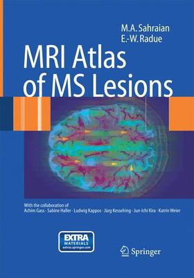 Sahraian / Radü |  MRI Atlas of MS Lesions | Buch |  Sack Fachmedien