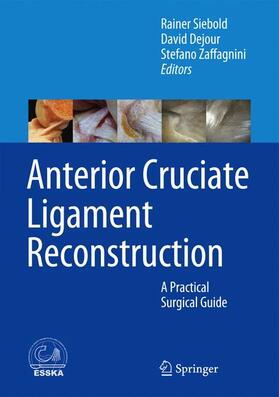 Siebold / Dejour / Zaffagnini |  Anterior Cruciate Ligament Reconstruction | Buch |  Sack Fachmedien