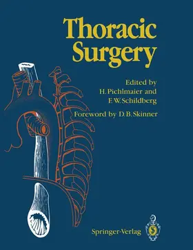 Pichlmaier / Schildberg |  Thoracic Surgery | Buch |  Sack Fachmedien