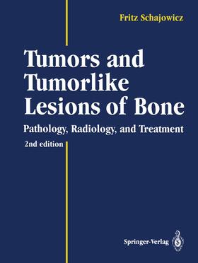 Schajowicz |  Tumors and Tumorlike Lesions of Bone | Buch |  Sack Fachmedien
