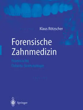 Rötzscher |  Forensische Zahnmedizin | eBook | Sack Fachmedien