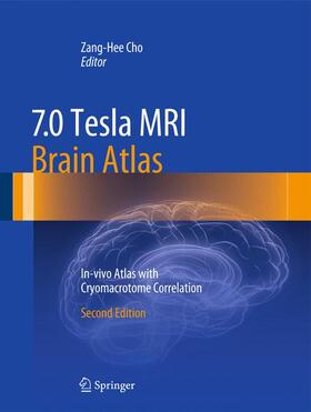 Cho |  7.0 Tesla MRI Brain Atlas | Buch |  Sack Fachmedien